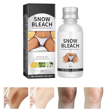 Dark Knees Remover Underarm Cream Body Moisturizer Lotion Dark Toe Knuckles Treatment Removal Remover Corrector for Armpit Elbow Inner Thigh Neck Private Part Intimate Legs Skin Cream, 30ML/1.0 Fl Oz