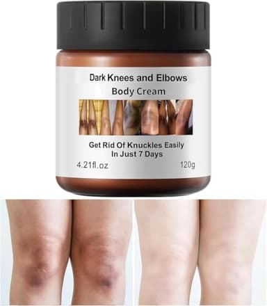 Dark Knees Remover Underarm Cream Body Moisturizer Lotion Dark Toe Knuckles Treatment Removal Remover Corrector for Armpit Elbow Inner Thigh Neck Private Part Intimate Legs Skin Cream - 120g/4.21oz